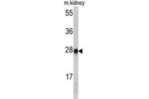 Western Blotting (WB) image for anti-Ethylmalonic Encephalopathy 1 (ETHE1) antibody (ABIN3002726) (ETHE1 antibody)