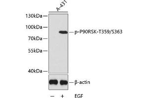 Western blot analysis of extracts of  cells, using Phospho-p90Rsk/RSK1/RPS6K-T359/S363 antibody (ABIN6135276, ABIN6136174, ABIN6136175 and ABIN6225566). (RPS6KA1 antibody  (pSer363, pThr359))