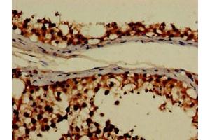 Immunohistochemistry (IHC) image for anti-Glyoxylate Reductase/hydroxypyruvate Reductase (GRHPR) (AA 1-328) antibody (ABIN7154260)