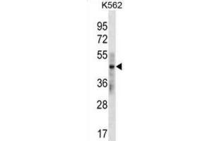 Western Blotting (WB) image for anti-Keratin 33B (KRT33B) antibody (ABIN3000386) (Keratin 33B antibody)