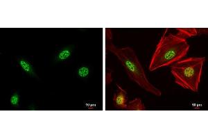 ICC/IF Image XBP1 antibody [N3C3] detects XBP1 protein at nucleus by immunofluorescent analysis.