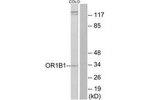 Western blot analysis of extracts from COLO cells, using OR1B1 Antibody. (OR1B1 antibody  (AA 161-210))