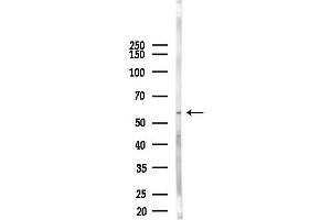 anti-Tyrosine Kinase, Non-Receptor, 1 (TNK1) (pTyr277) antibody