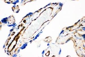 IHC-P: Caveolin-1 antibody testing of human placenta tissue (Caveolin-1 antibody  (AA 4-178))
