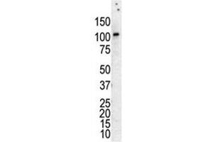 Western Blotting (WB) image for anti-Protein Kinase D3 (PRKD3) (AA 352-384) antibody (ABIN3032380)