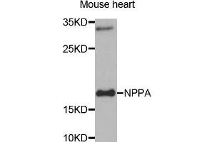 Western blot analysis of extracts of Mouse heart tissue, using NPPA antibody. (NPPA antibody)