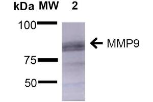 Western Blot analysis of Rat Brain showing detection of ~92 kDa and ~82 kDa (pro and active) MMP9 protein using Mouse Anti-MMP9 Monoclonal Antibody, Clone S51-82 . (MMP 9 antibody  (AA 1-708) (Atto 488))