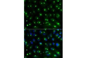 Immunofluorescence analysis of MCF-7 cell using GGA2 antibody. (GGA2 antibody  (AA 1-300))