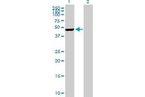 Western Blot analysis of PIP4K2C expression in transfected 293T cell line by PIP4K2C MaxPab polyclonal antibody. (PIP4K2C antibody  (AA 1-421))