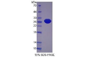 Image no. 1 for Xanthine Dehydrogenase (XDH) (AA 2-219) protein (His tag) (ABIN6236894)