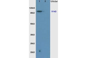 L1 rat brain, L2 rat liver lysates probed  at 1:200 in 4˚C. (SLC9A1 antibody  (AA 470-550))