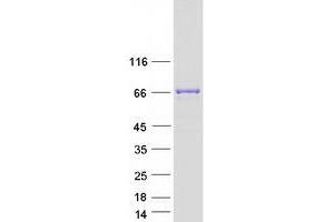 Validation with Western Blot