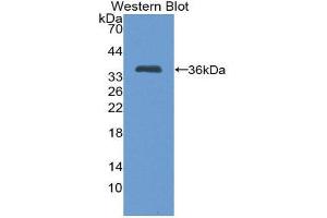 Western Blotting (WB) image for anti-Trefoil Factor 1 (TFF1) (AA 25-84) antibody (ABIN1860705) (TFF1 antibody  (AA 25-84))