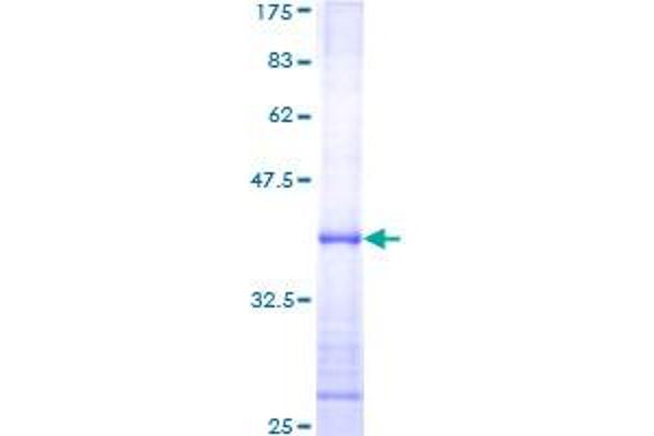 SMAD1 Protein (AA 1-110) (GST tag)