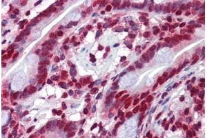 Human Small Intestine: Formalin-Fixed, Paraffin-Embedded (FFPE) (RHOU antibody  (C-Term))