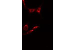 ABIN6278589 staining  HepG2 cells by IF/ICC. (MAK antibody  (Internal Region))