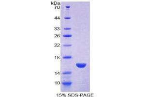 SDS-PAGE (SDS) image for Myeloperoxidase (MPO) (AA 165-278) protein (His tag) (ABIN1080347)