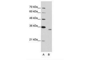 Image no. 2 for anti-RNA Binding Motif Protein 4B (RBM4B) (AA 290-339) antibody (ABIN202338) (RBM4B antibody  (AA 290-339))