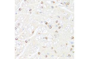 Immunohistochemistry (Paraffin-embedded Sections) (IHC (p)) image for anti-Polymerase (RNA) II (DNA Directed) Polypeptide B, 140kDa (POLR2B) (AA 1-260) antibody (ABIN6145916)