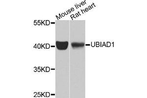 Western blot analysis of extracts of various cell lines, using UBIAD1 antibody (ABIN5975826) at 1/1000 dilution. (UBIAD1 antibody)