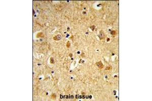 Formalin-fixed and paraffin-embedded human brain tissue reacted with DNM3 Antibody , which was peroxidase-conjugated to the secondary antibody, followed by DAB staining. (Dynamin 3 antibody  (AA 557-584))
