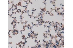 Used in DAB staining on fromalin fixed paraffin- embedded lung tissue (ERP29 antibody  (AA 42-173))