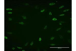 Immunofluorescence of monoclonal antibody to ZBTB33 on HeLa cell.