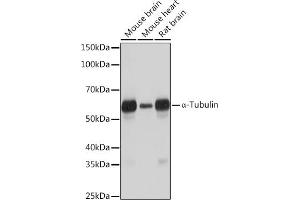 Western blot analysis of extracts of various cell lines, using α-Tubulin Rabbit mAb (ABIN7271036) at 1:1000 dilution. (TUBA4A antibody)