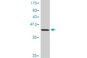 Western Blot detection against Immunogen (38. (SP1 antibody  (AA 89-198))