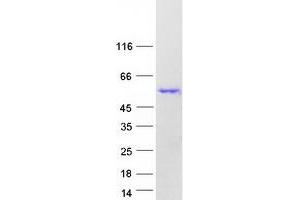 Validation with Western Blot (CELF2 Protein (Transcript Variant 4) (Myc-DYKDDDDK Tag))