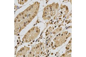 Immunohistochemistry (IHC) image for anti-X-Ray Repair Complementing Defective Repair in Chinese Hamster Cells 3 (XRCC3) (AA 62-346) antibody (ABIN3023006)