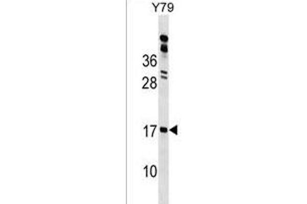 GLIPR2 antibody  (N-Term)