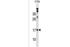 GR1 Antibody (N-term) 18154a western blot analysis in Y79 cell line lysates (35 μg/lane). (GLIPR2 antibody  (N-Term))