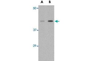 Western blot analysis of AGTR1 in mouse kidney tissue lysate with AGTR1 polyclonal antibody  at (A) 1 and (B) 2 ug/mL . (Angiotensin II Type-1 Receptor antibody  (Internal Region))