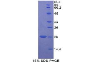 SDS-PAGE (SDS) image for BCL2-Like 2 (BCL2L2) (AA 11-171) protein (His tag) (ABIN1877347) (BCL2L2 Protein (AA 11-171) (His tag))