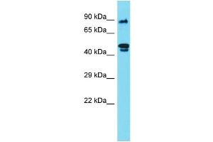 Host: Rabbit Target Name: RSPH4A Sample Type: 721_B Whole Cell lysates Antibody Dilution: 1. (RSPH4A antibody  (N-Term))