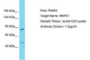 Host: Rabbit Target Name: NKPD1 Sample Type: Jurkat Whole Cell lysates Antibody Dilution: 1. (NKPD1 antibody  (N-Term))
