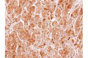 IHC-P Image Immunohistochemical analysis of paraffin-embedded MCF7 xenograft, using MVD, antibody at 1:100 dilution. (MVD antibody  (Center))