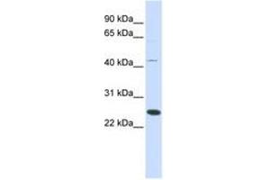 Image no. 1 for anti-Family With Sequence Similarity 119A (FAM119A) (AA 72-121) antibody (ABIN6741188) (FAM119A antibody  (AA 72-121))
