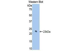 Western Blotting (WB) image for anti-Keratin 7 (KRT7) (AA 255-393) antibody (ABIN1859582)