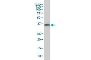 BVES monoclonal antibody (M02), clone 3F7 Western Blot analysis of BVES expression in IMR-32 . (BVES antibody  (AA 262-360))