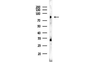 anti-Transmembrane Channel-Like 7 (TMC7) (C-Term) antibody