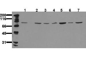 Western Blotting (WB) image for anti-Protein Kinase C, theta (PRKCQ) (C-Term) antibody (ABIN492623) (PKC theta antibody  (C-Term))