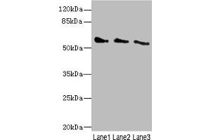 Western blot All lanes: CHRNG antibody at 5. (CHRNG antibody  (AA 328-517))