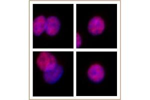 Immunofluorescence (IF) image for anti-SWI/SNF Related, Matrix Associated, Actin Dependent Regulator of Chromatin, Subfamily C, Member 2 (SMARCC2) (C-Term) antibody (ABIN6972747)