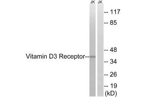 Western Blotting (WB) image for anti-Vitamin D Receptor (VDR) (Ser51) antibody (ABIN1848276) (Vitamin D Receptor antibody  (Ser51))