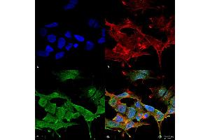 Immunocytochemistry/Immunofluorescence analysis using Mouse Anti-Clcn3 Monoclonal Antibody, Clone S258-5 . (CLCN3 antibody  (AA 98-115) (PE))