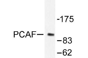 Image no. 2 for anti-K(lysine) Acetyltransferase 2B (KAT2B) antibody (ABIN271904) (KAT2B antibody)