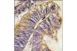 Image no. 1 for anti-PH Domain and Leucine Rich Repeat Protein Phosphatase 2 (PHLPP2) (N-Term) antibody (ABIN360110) (PHLPP2 antibody  (N-Term))