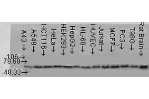 Western blot analysis of multiple Cell line lysates showing detection of AKT2 protein using Rabbit Anti-AKT2 Polyclonal Antibody . (AKT2 antibody  (C-Term) (Biotin))